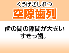 空隙歯列
