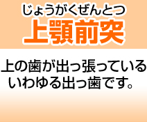 上顎前突