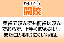 開咬